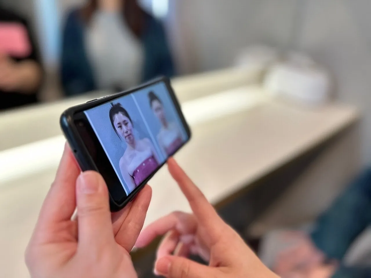 施術後の写真の確認