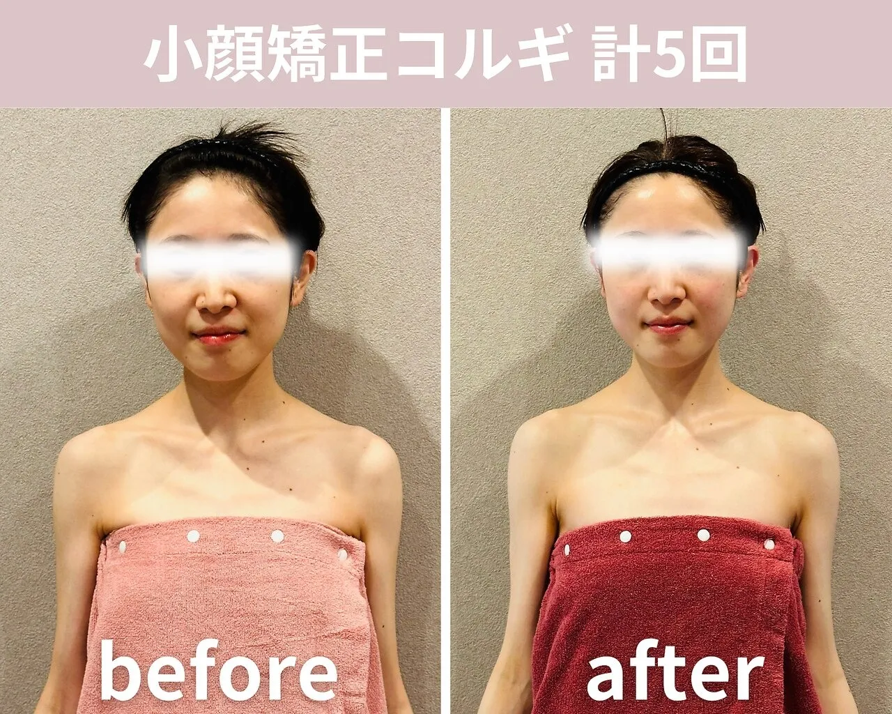 【小顔矯正コルギ】計5回の結果