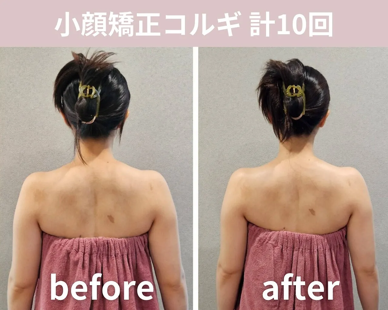 【小顔矯正コルギ】計10回の結果