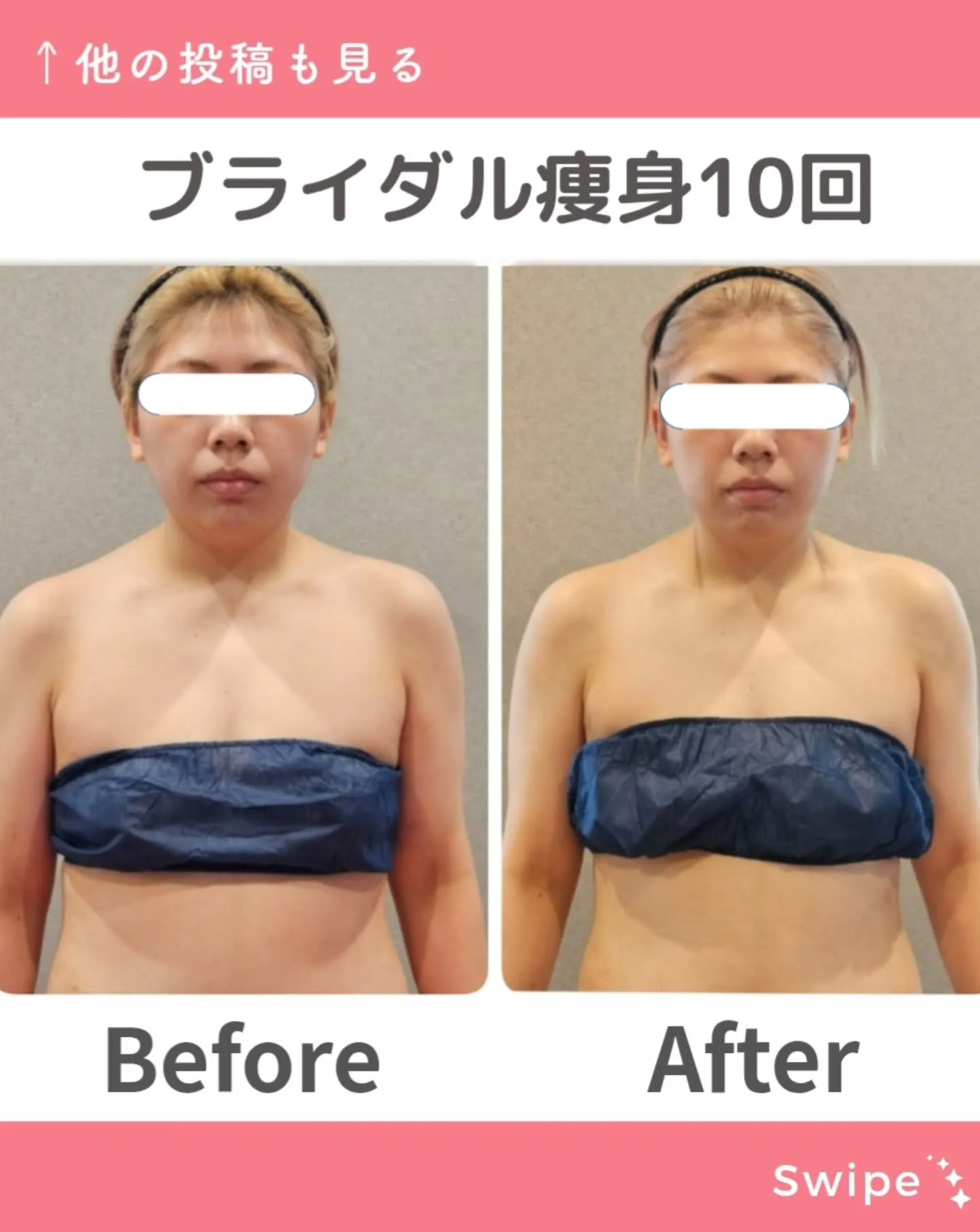 ブライダル痩身上半身集中コース‼️