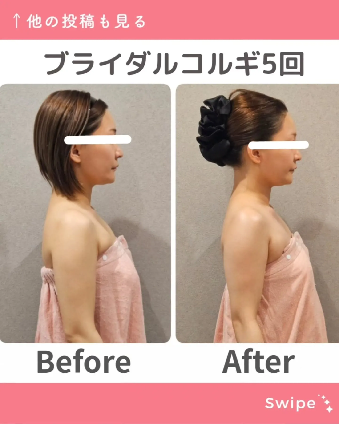 大人気ブライダル小顔コルギ👧