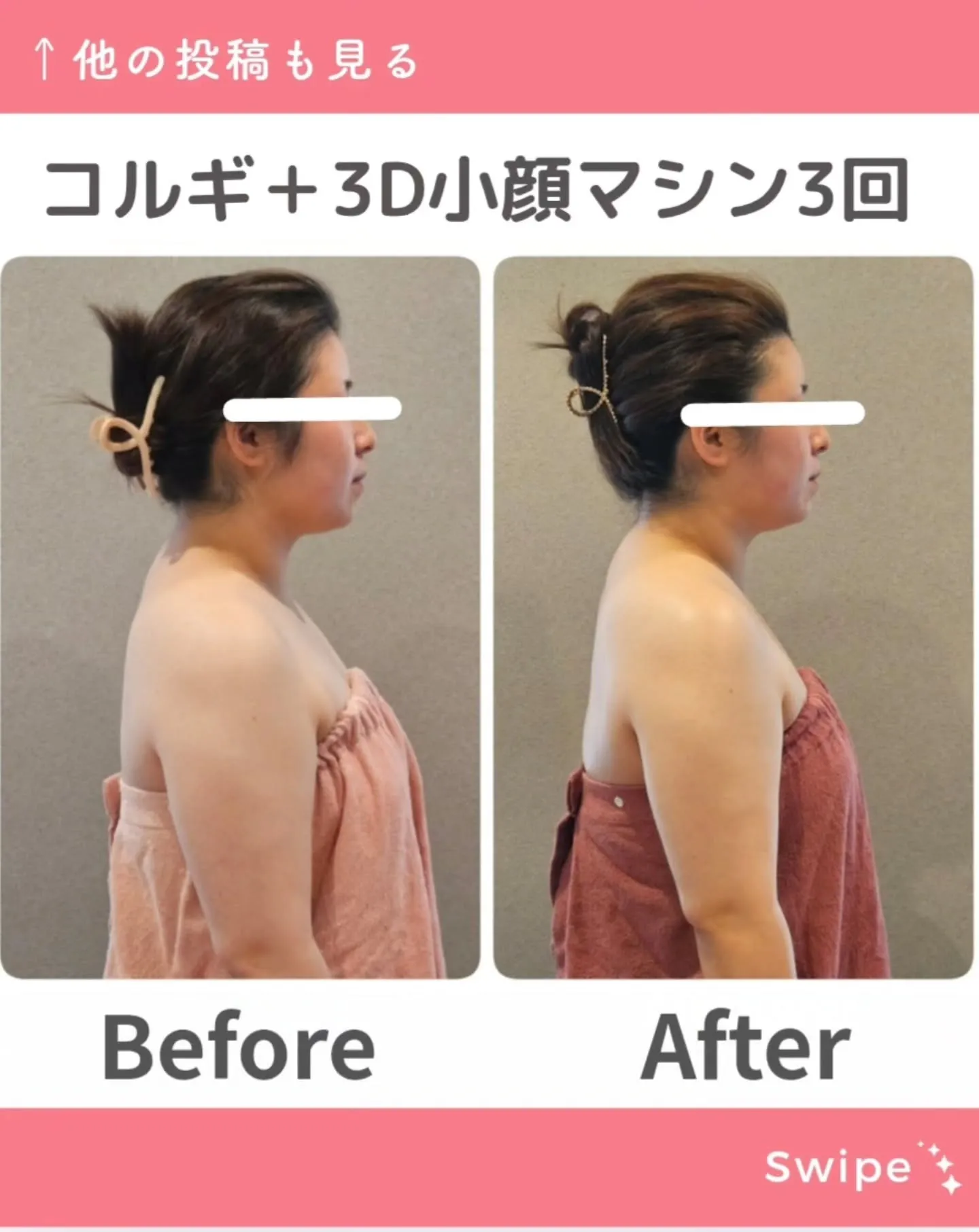 Feliciaで人気No.1メニュー 小顔コルギ✨
