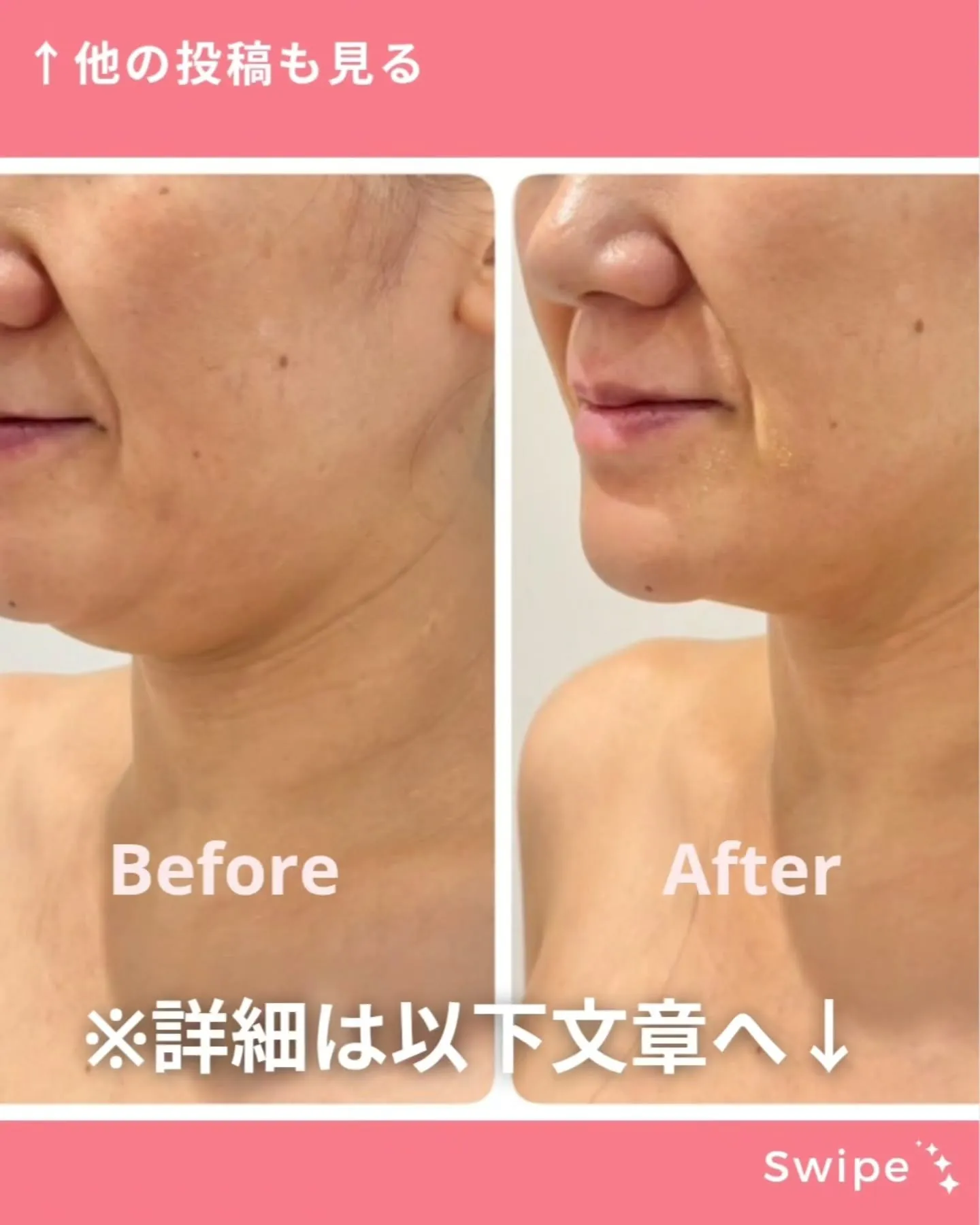 今回は、【レモンボトル】のクーポン各種についてご紹介します✨
