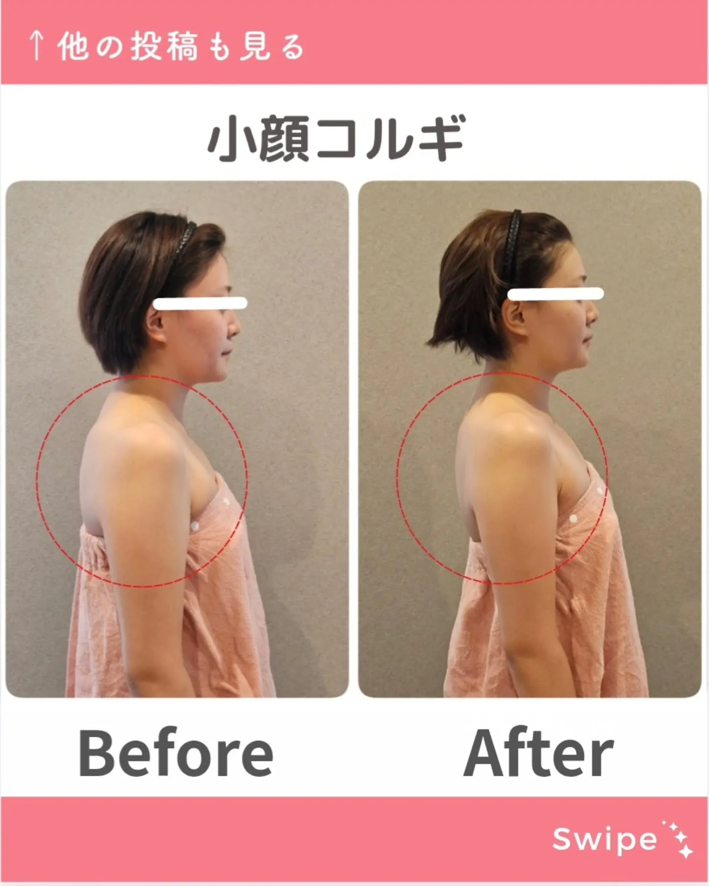 Feliciaのコルギはただ小顔になるだけではありません😊